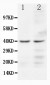 Anti-CCR5 Antibody